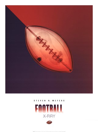 Framed Football X-Ray Print