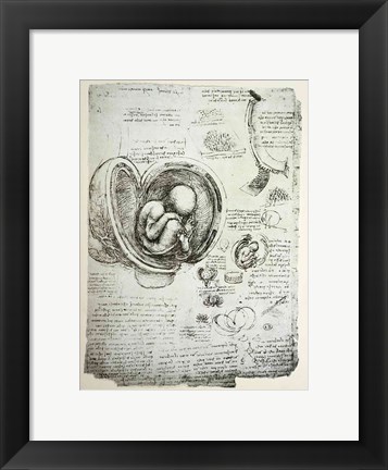 Framed Human Fetus in the Womb Print