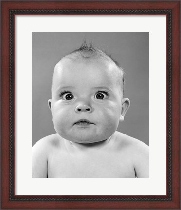 Framed 1950s Close-Up Of Baby Cross-Eyed Print
