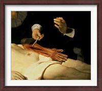 Framed Anatomy Lesson of Dr. Nicolaes Tulp, 1632 (arm detail)