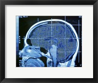 Framed Close-up of an MRI scan of the human brain