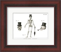 Framed Dandy Bones